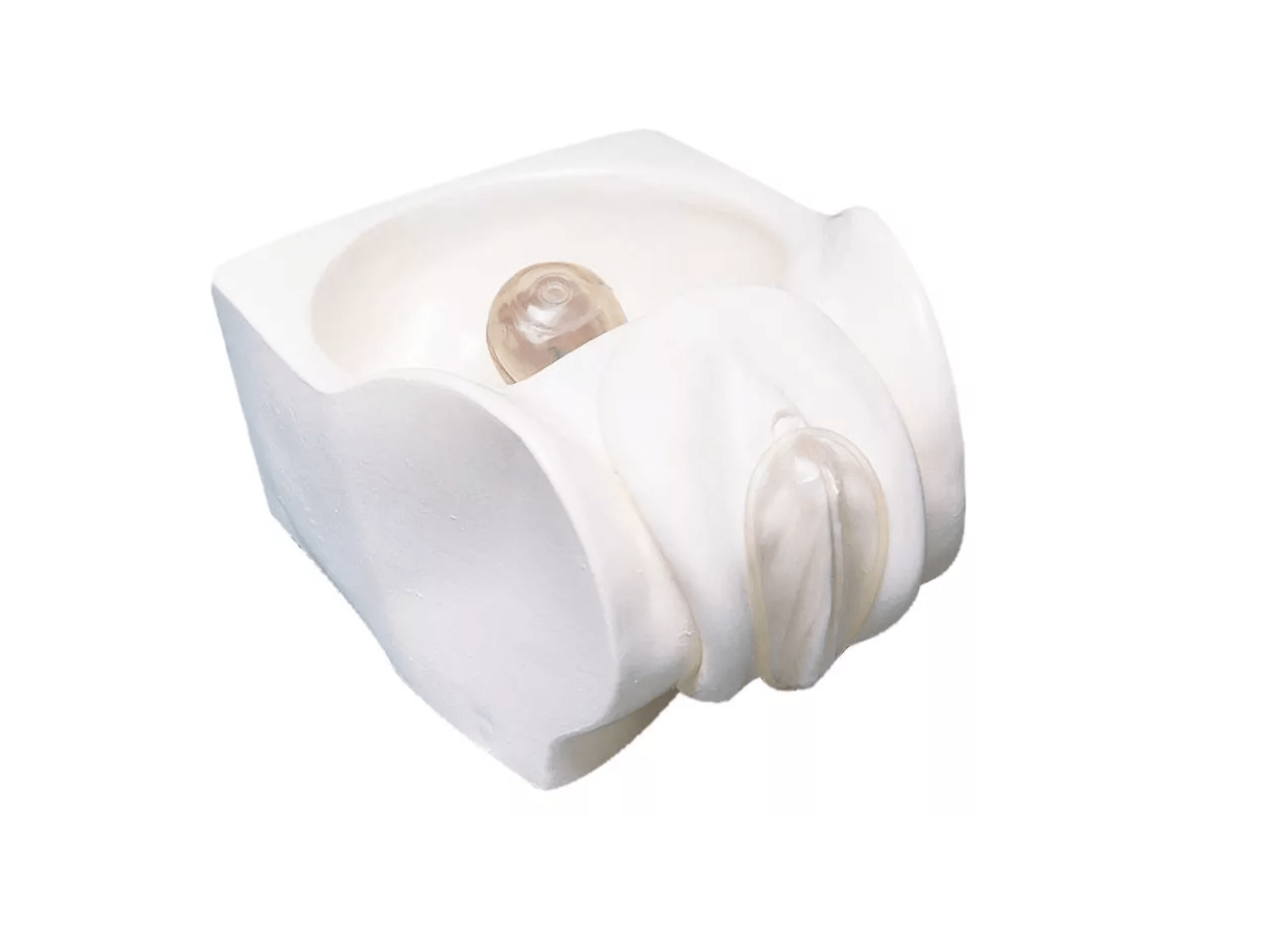 Scheidenkondom - Modell - Erler - Zimmer